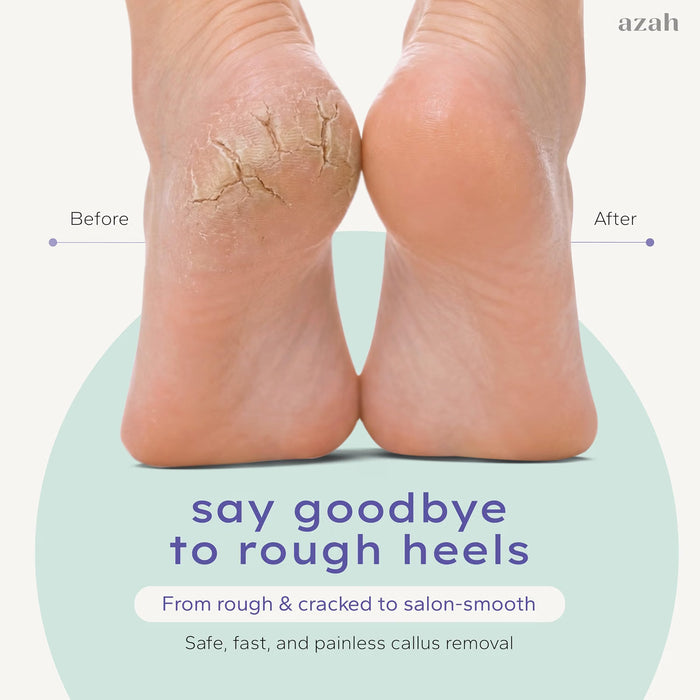 Electric Callus Remover | Salon-Soft Feet at Home