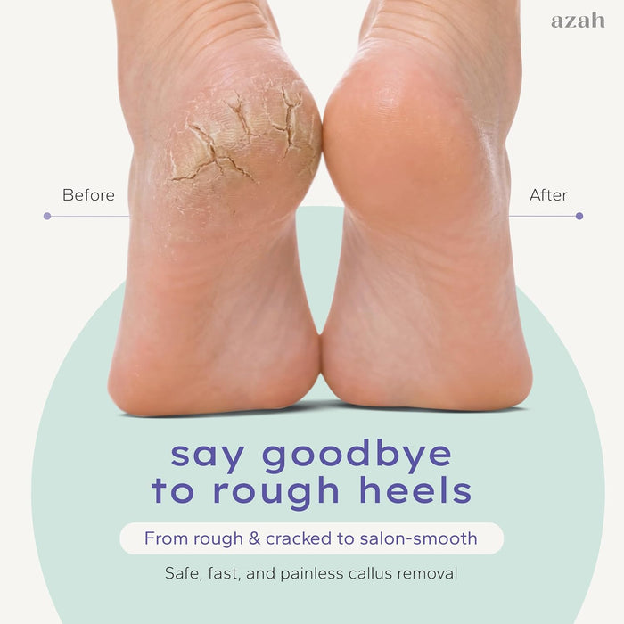 Electric Callus Remover for Feet | IPX6 Waterproof | 3 Replaceable Rollers | Dual Speed