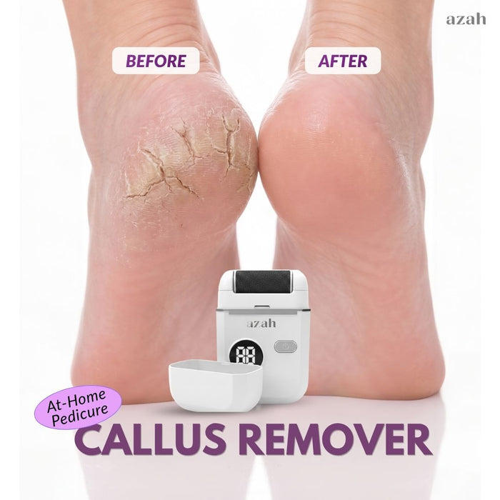 Electric Callus Remover | Salon-Soft Feet at Home AZAH