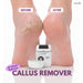 Electric Callus Remover | Salon-Soft Feet at Home AZAH